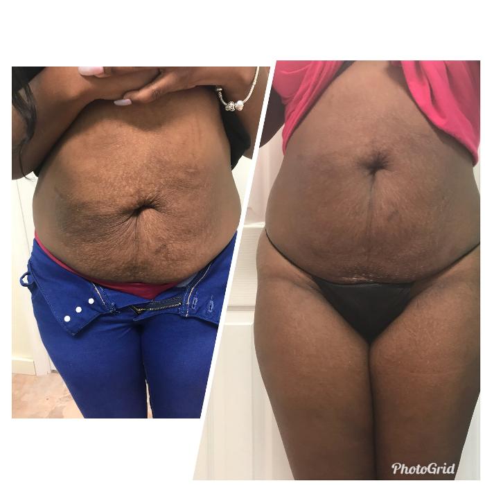 Beautisculpt Studio LLC - Stafford, TX