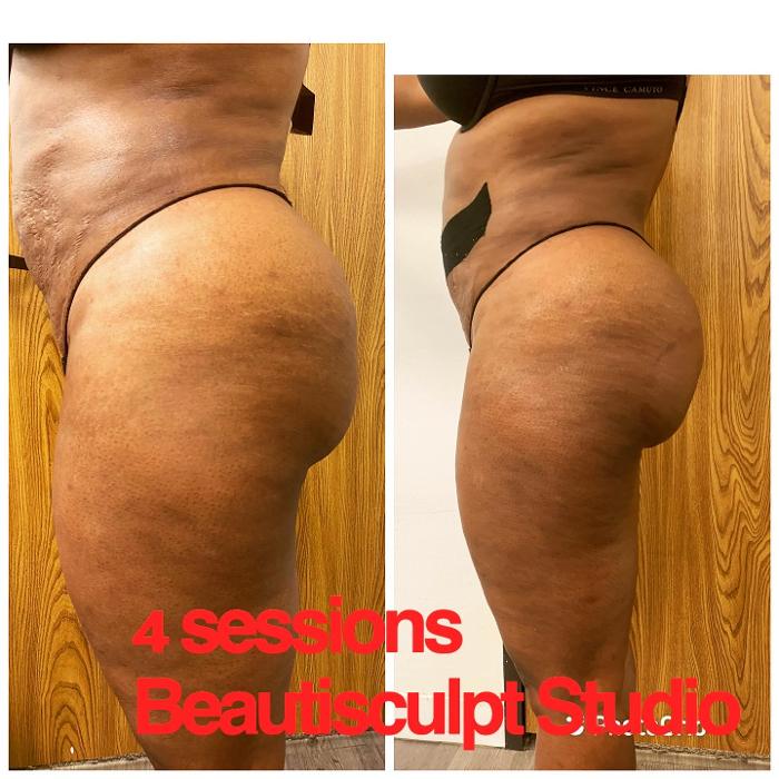 Beautisculpt Studio LLC - Stafford, TX