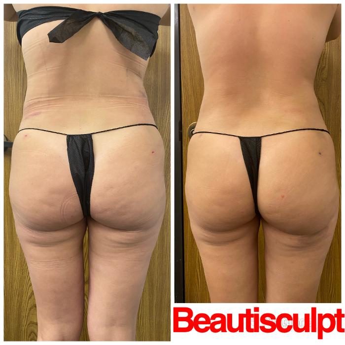 Beautisculpt Studio LLC - Stafford, TX
