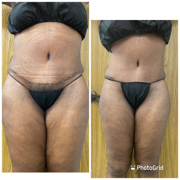 Beautisculpt Studio LLC - Stafford, TX