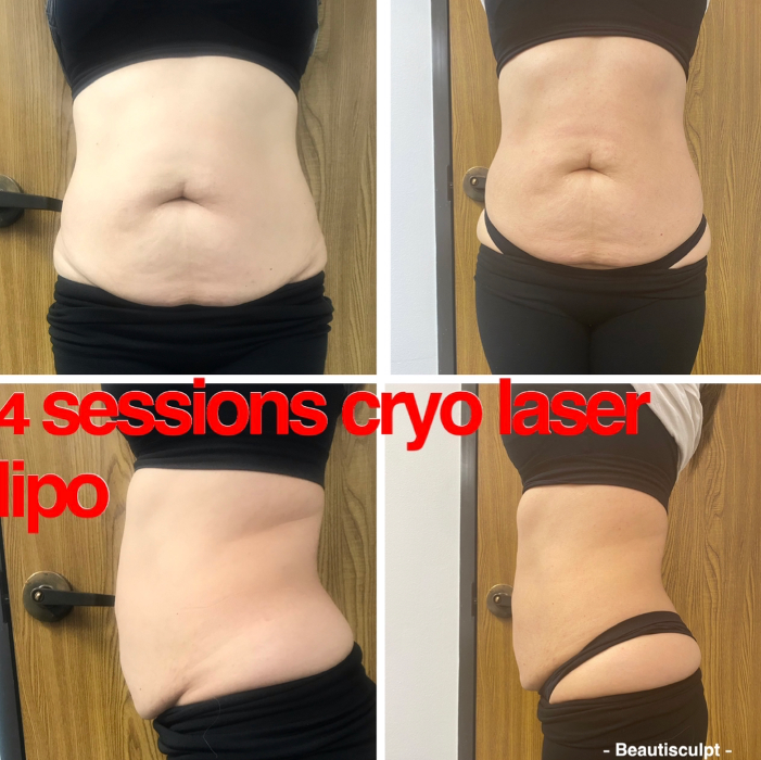 Beautisculpt Studio LLC - Stafford, TX