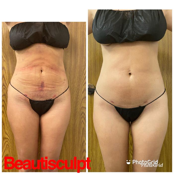 Beautisculpt Studio LLC - Stafford, TX