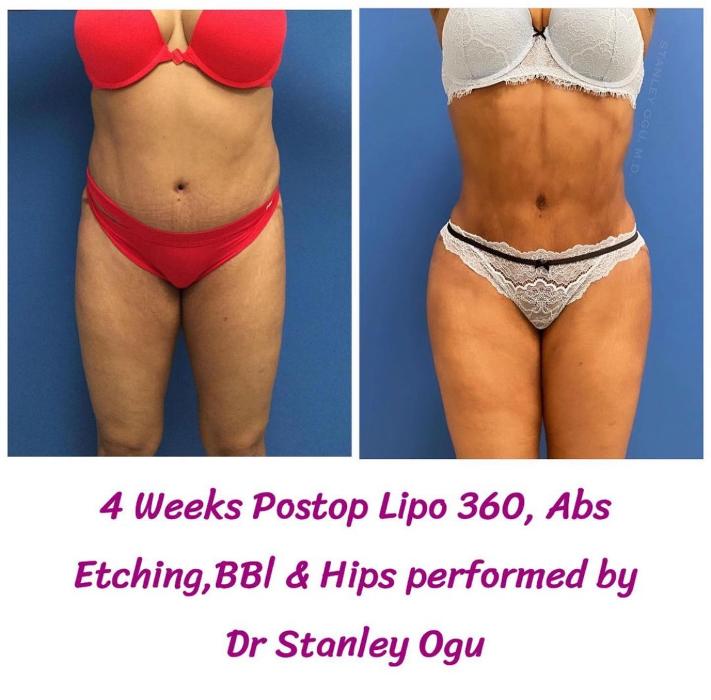 Beautisculpt Studio LLC - Stafford, TX