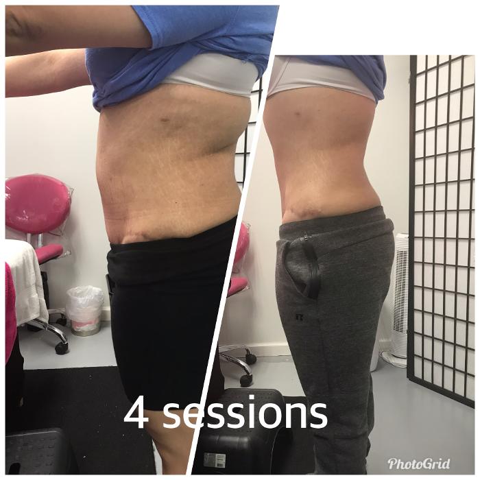 Beautisculpt Studio LLC - Stafford, TX