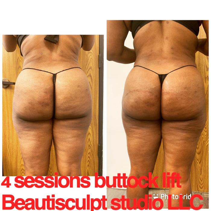 Beautisculpt Studio LLC - Stafford, TX
