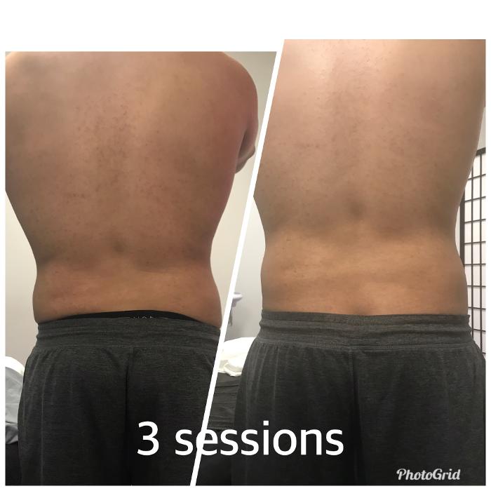 Beautisculpt Studio LLC - Stafford, TX