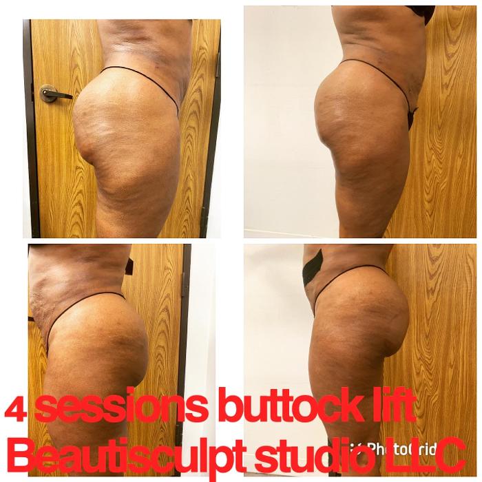 Beautisculpt Studio LLC - Stafford, TX