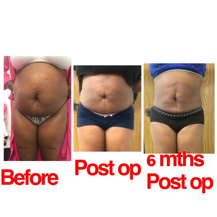 Beautisculpt Studio LLC - Stafford, TX