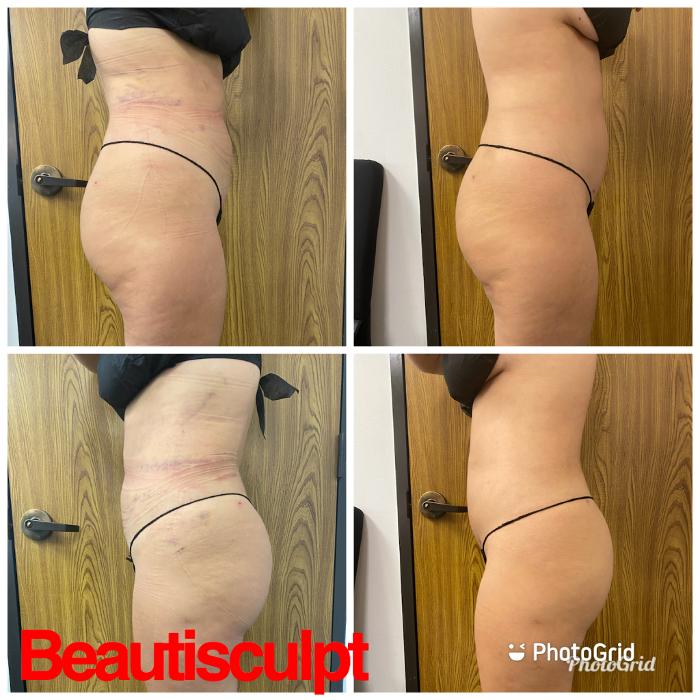 Beautisculpt Studio LLC - Stafford, TX
