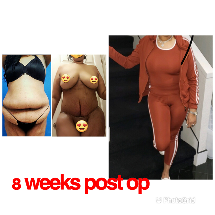 Beautisculpt Studio LLC - Stafford, TX