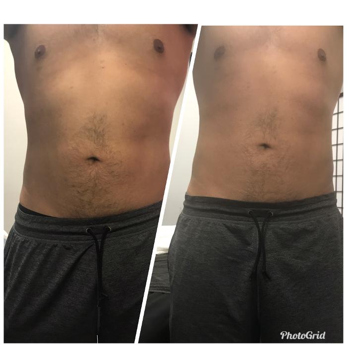 Beautisculpt Studio LLC - Stafford, TX