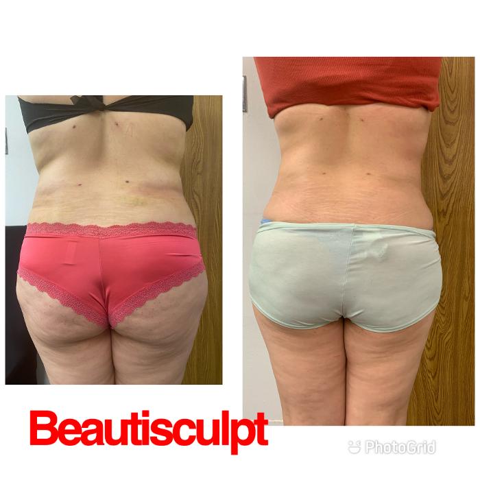 Beautisculpt Studio LLC - Stafford, TX