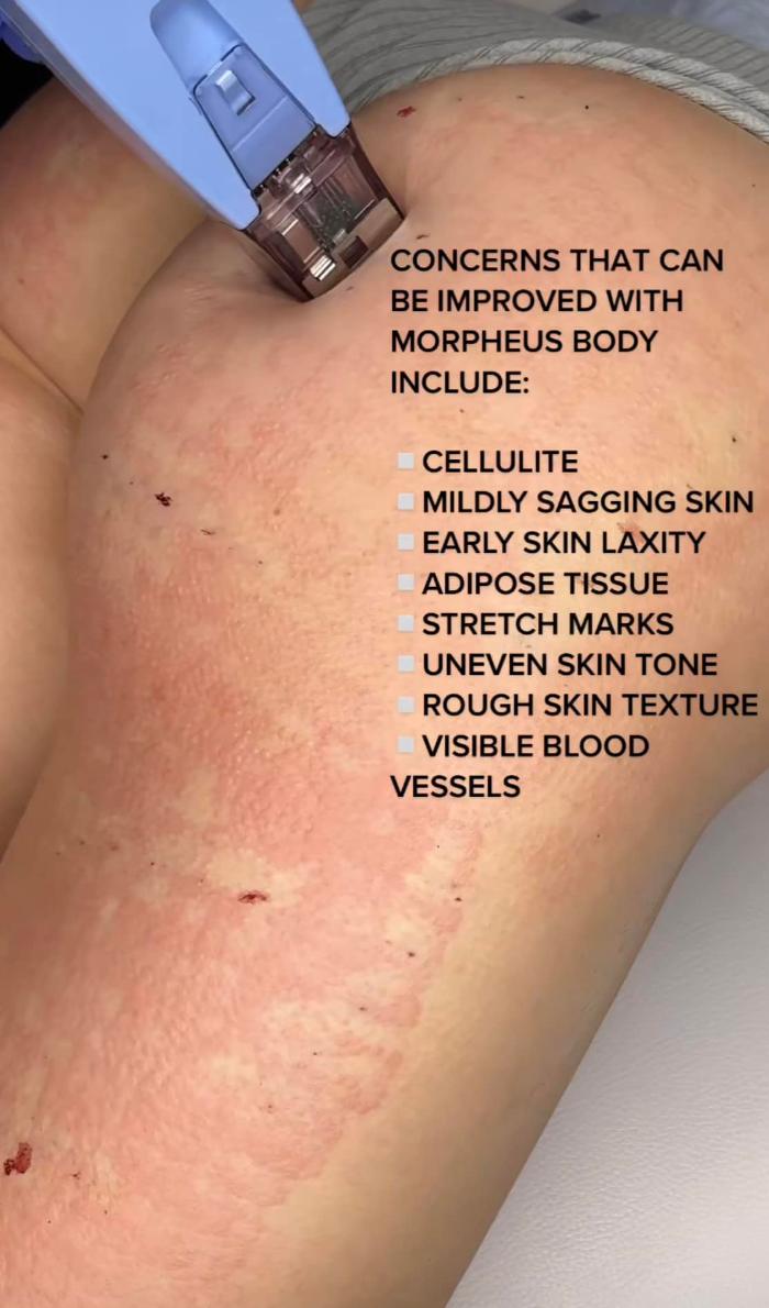 Eden Med Spa - Bismarck, ND