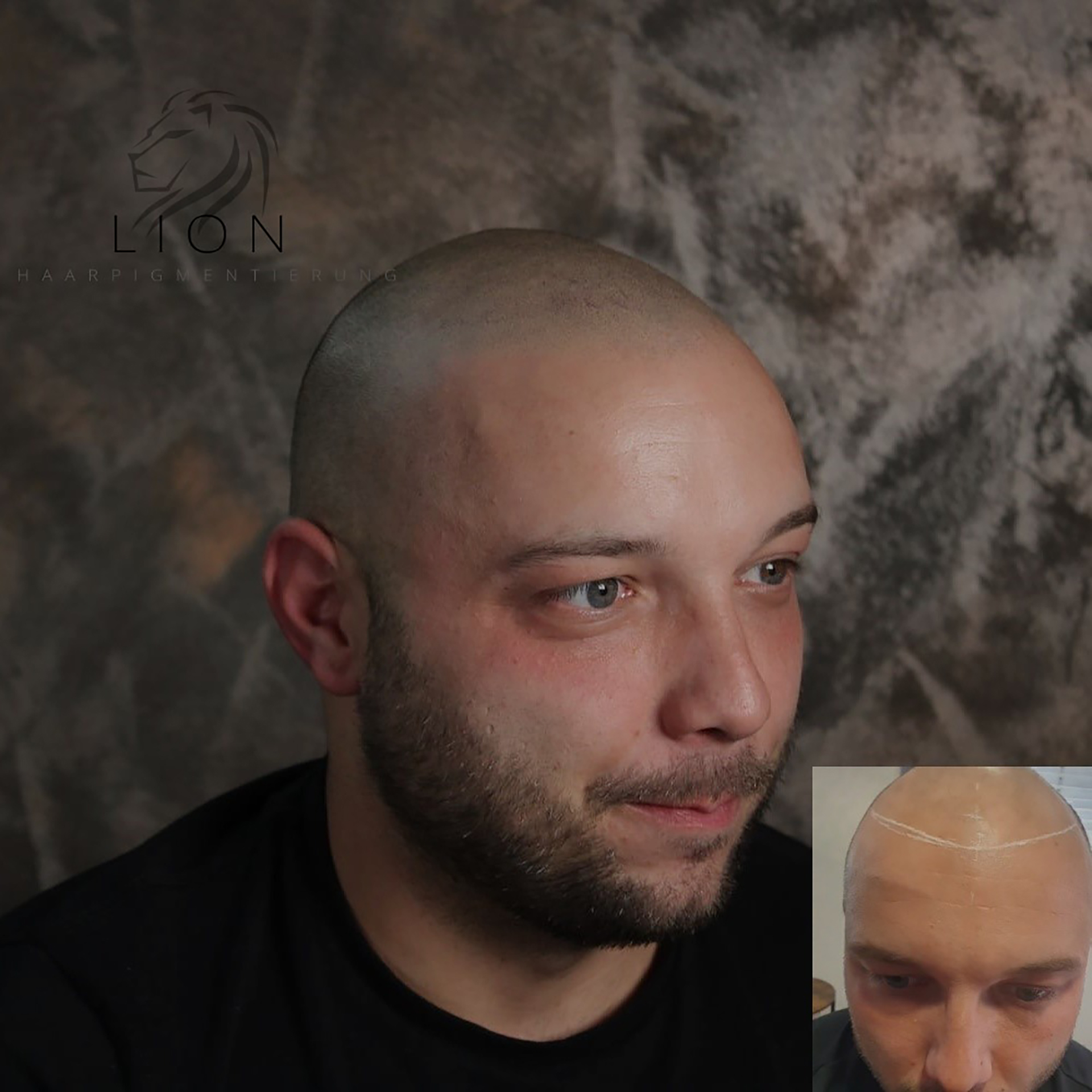 Galerie-Thumbnail