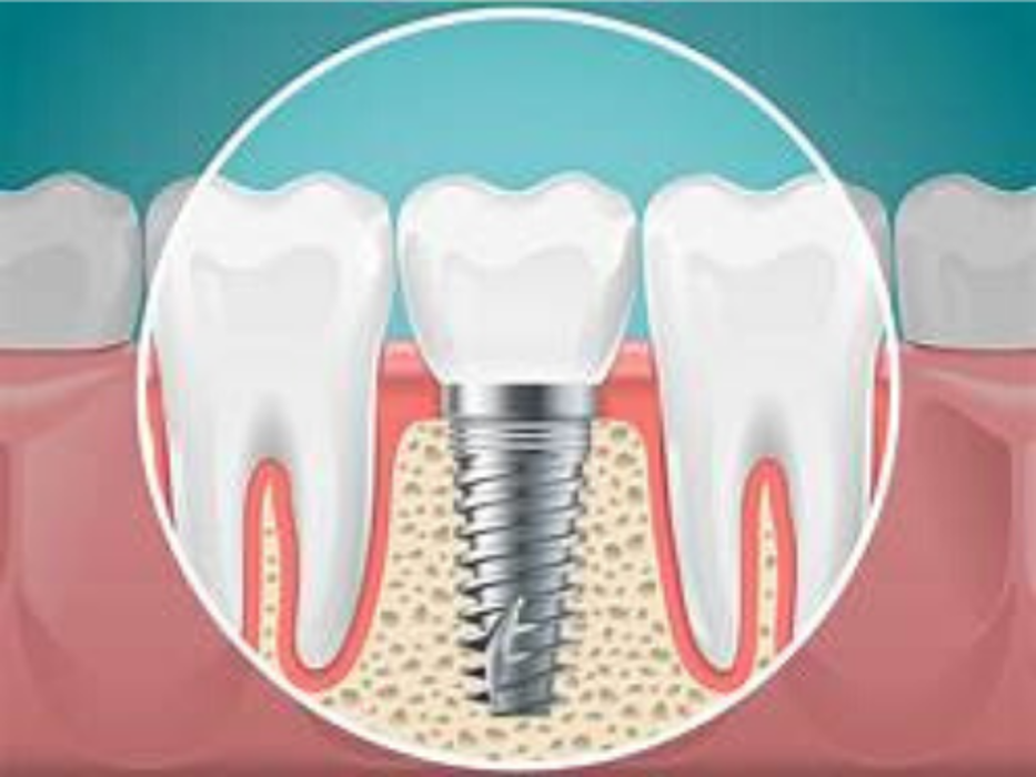 Bandy Dental Image
