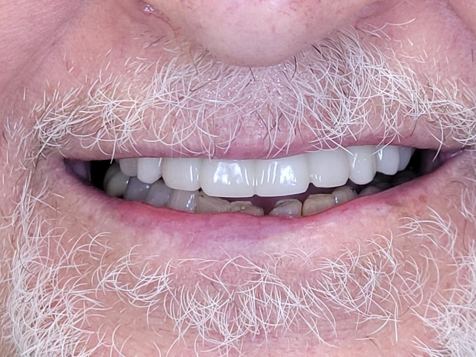 Smile Cape Coral Image