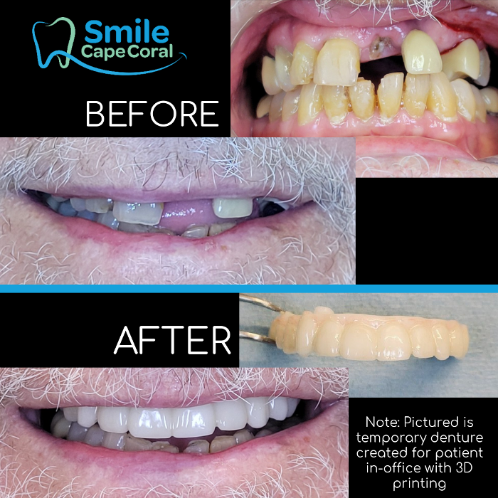 Smile Cape Coral Image