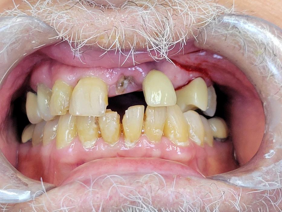 Smile Cape Coral Image