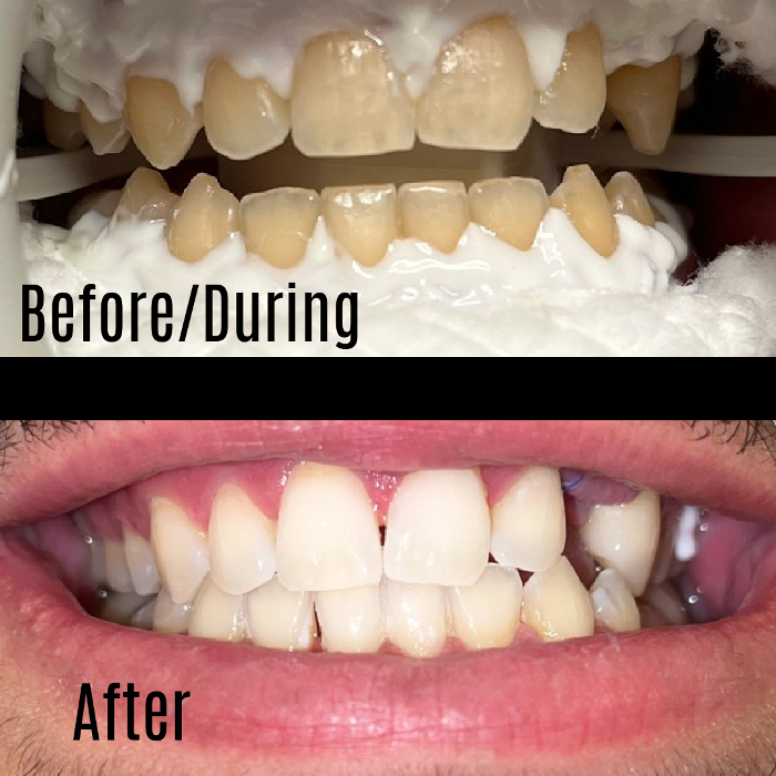 Estero Bay Dental Image