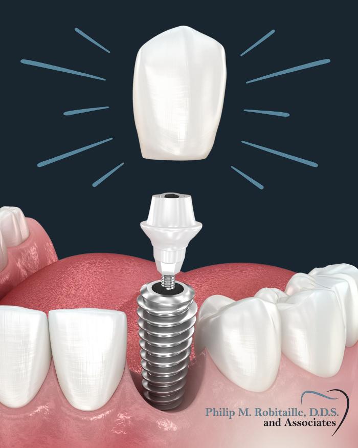 Philip M Robitaille, D.D.S. & Associates Image