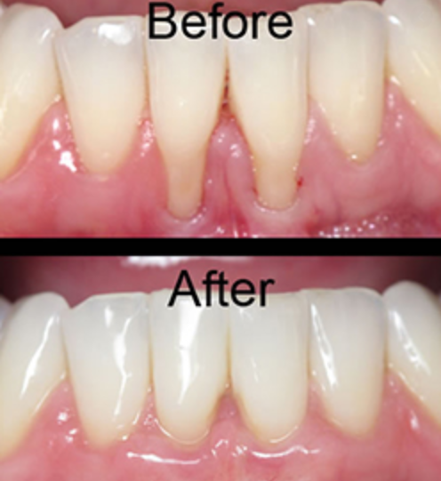 Image 4 | Larry A. Johnson, DDS, PC