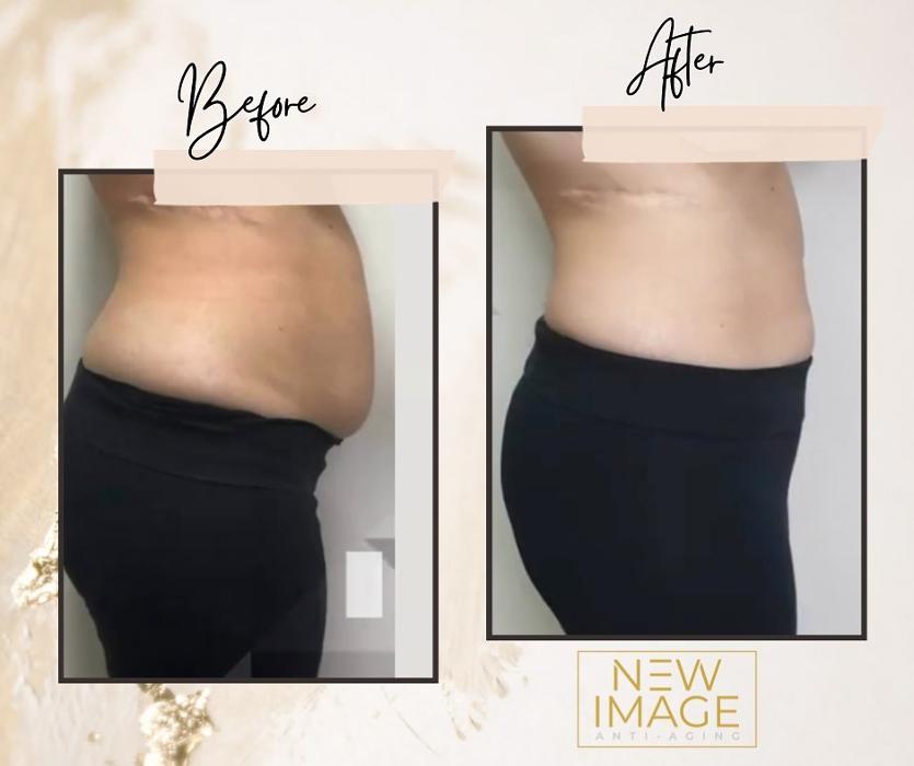 New Image Anti Aging & Weight Loss Center Image