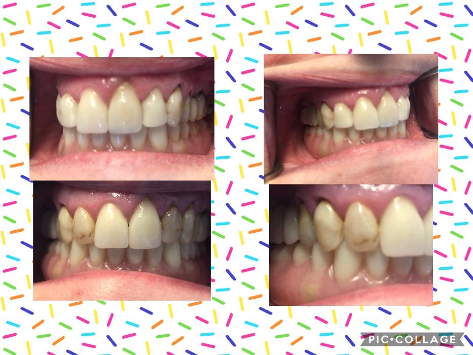 Progressive Dental Image