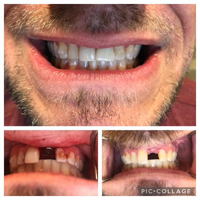 Progressive Dental Image