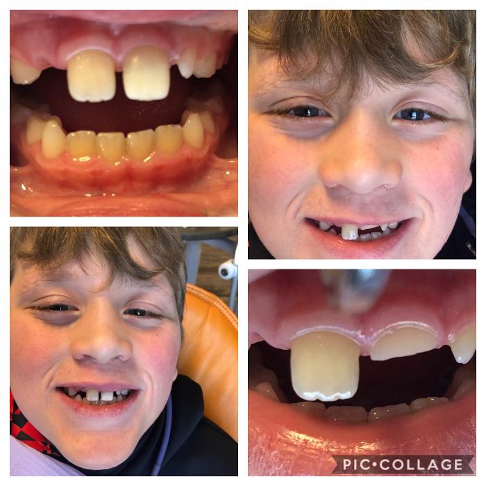 Progressive Dental Image