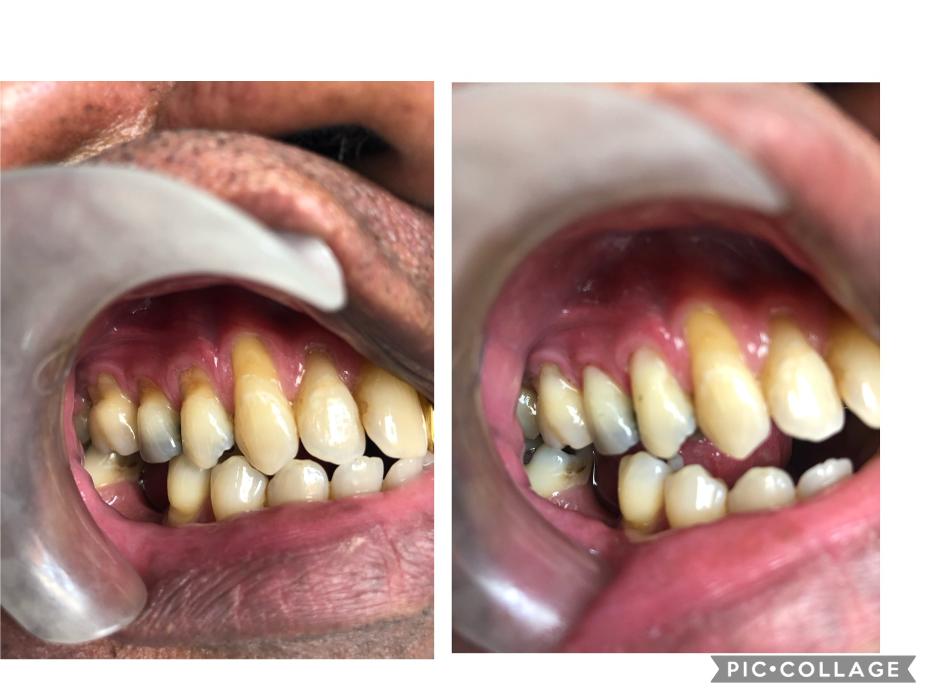 Progressive Dental Image