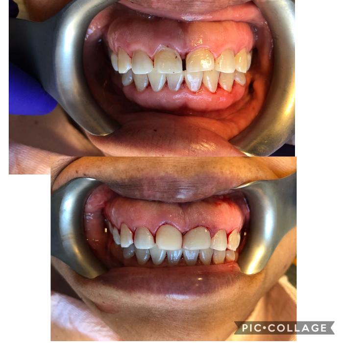 Progressive Dental Image