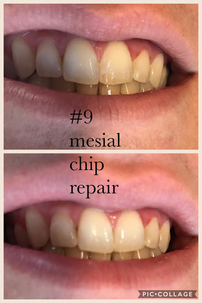 Progressive Dental Image