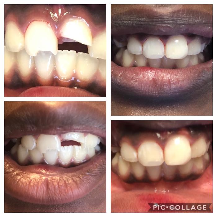 Progressive Dental Image