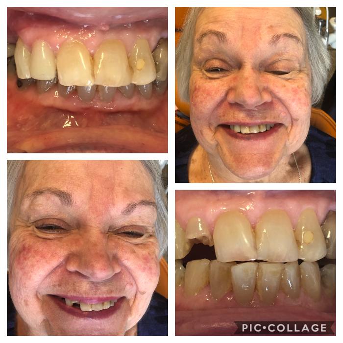 Progressive Dental Image