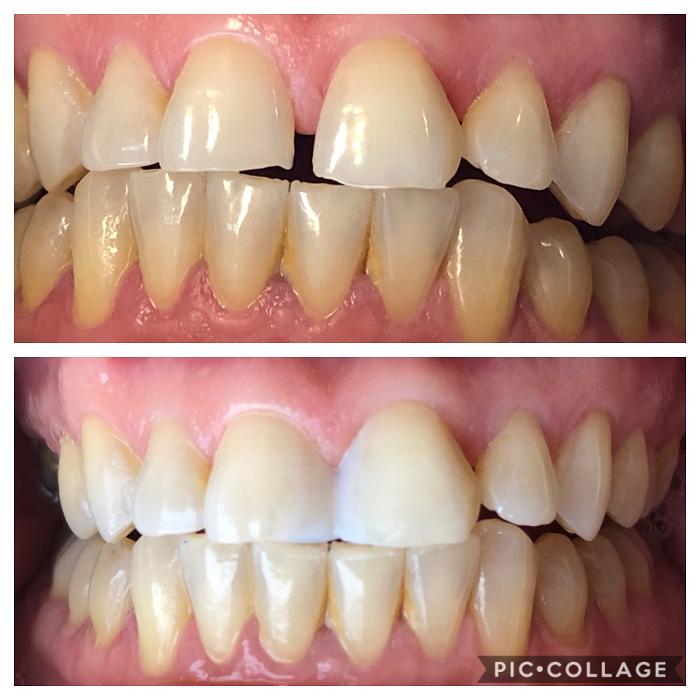 Progressive Dental Image