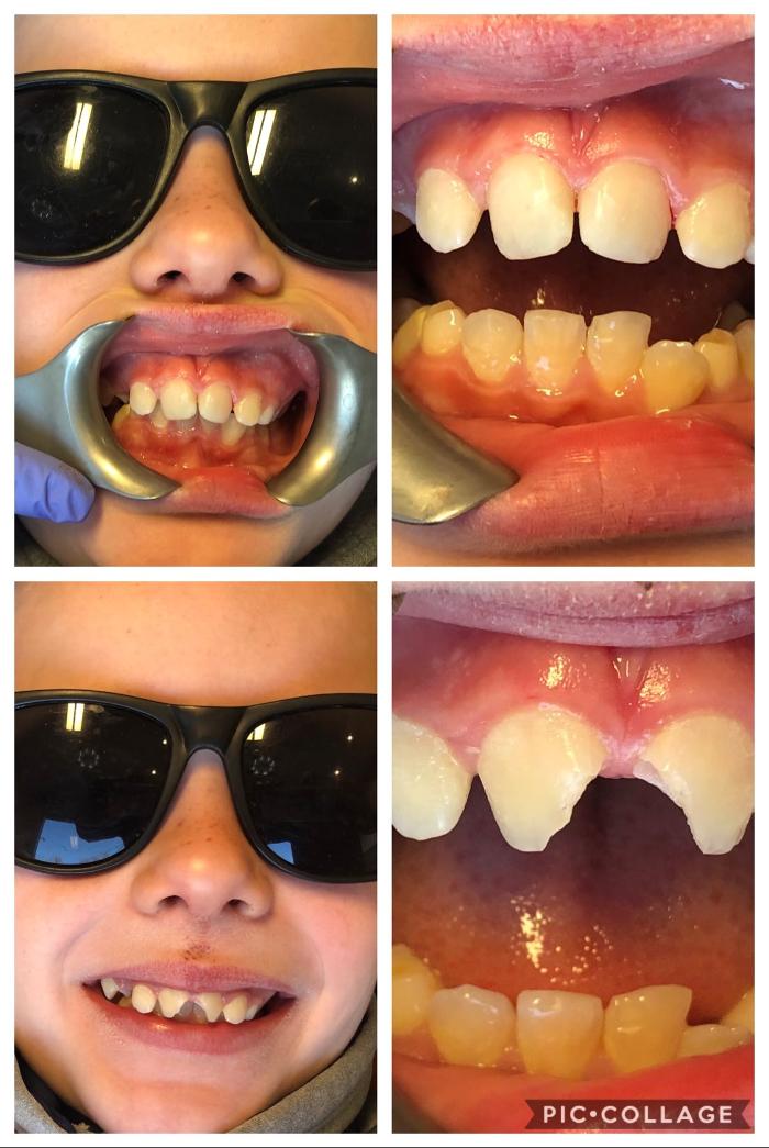 Progressive Dental Image