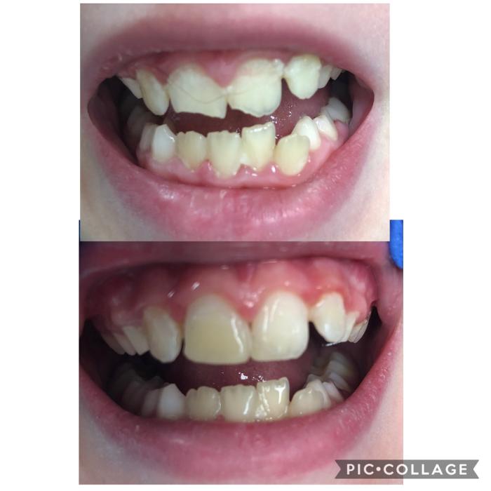 Progressive Dental Image