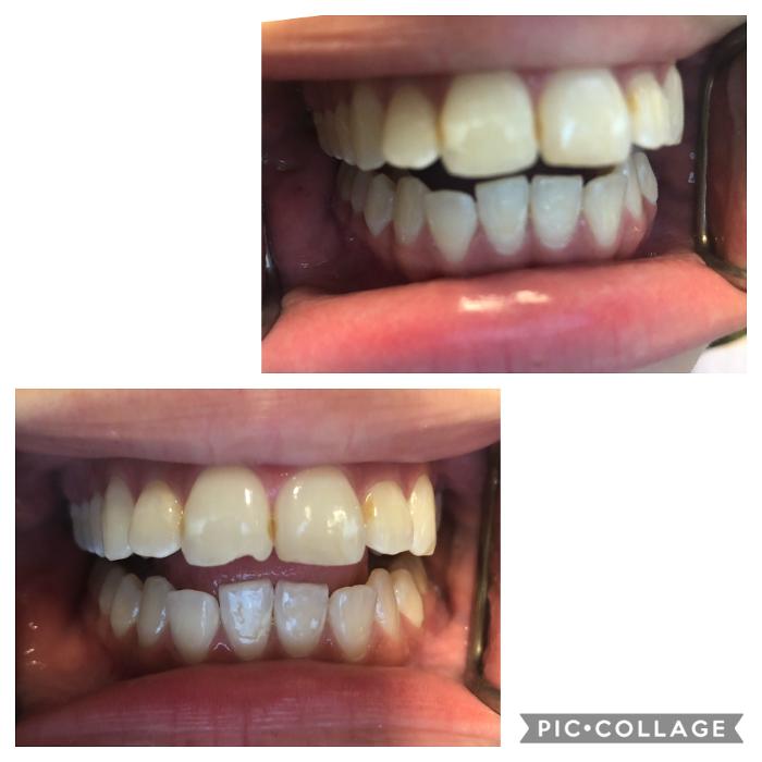 Progressive Dental Image