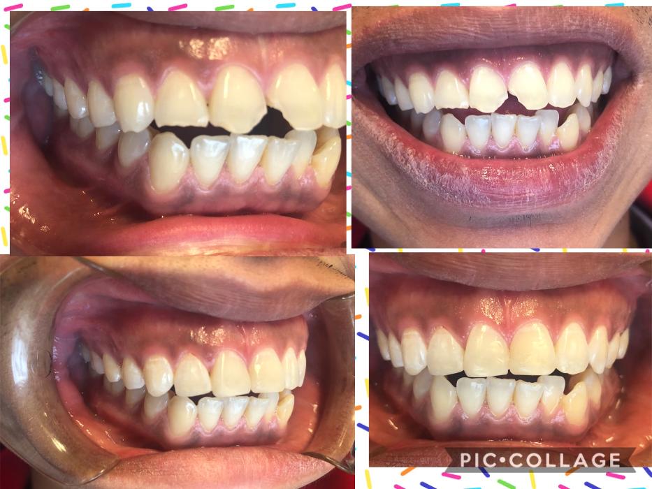 Progressive Dental Image