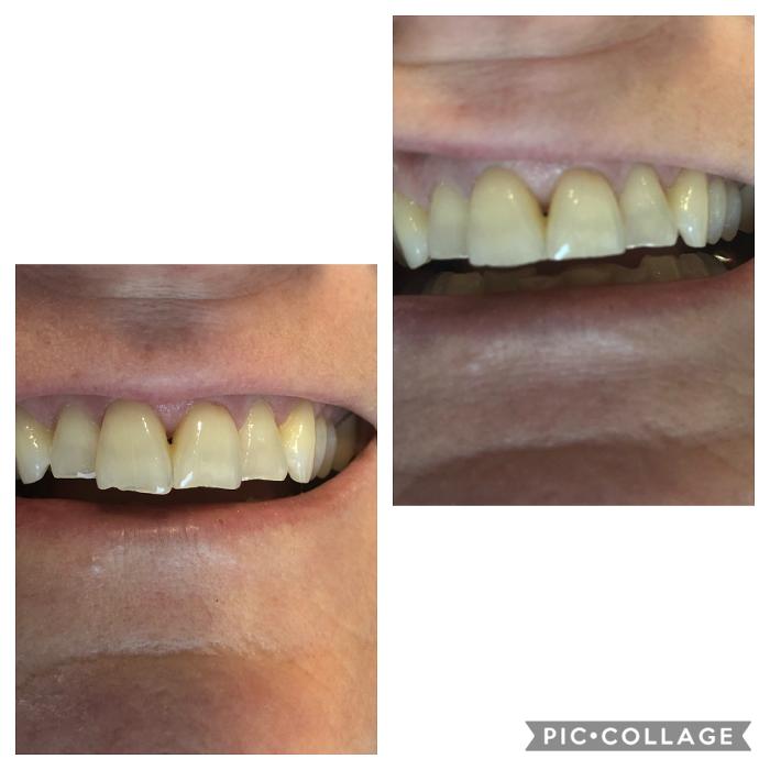 Progressive Dental Image