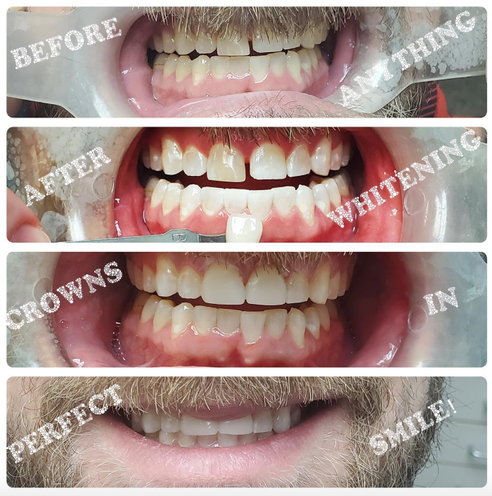 Progressive Dental Image