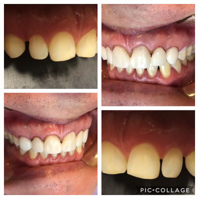 Progressive Dental Image