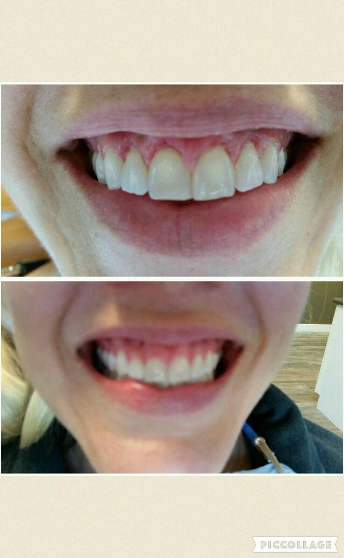 Progressive Dental Image