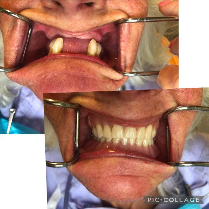 Progressive Dental Image