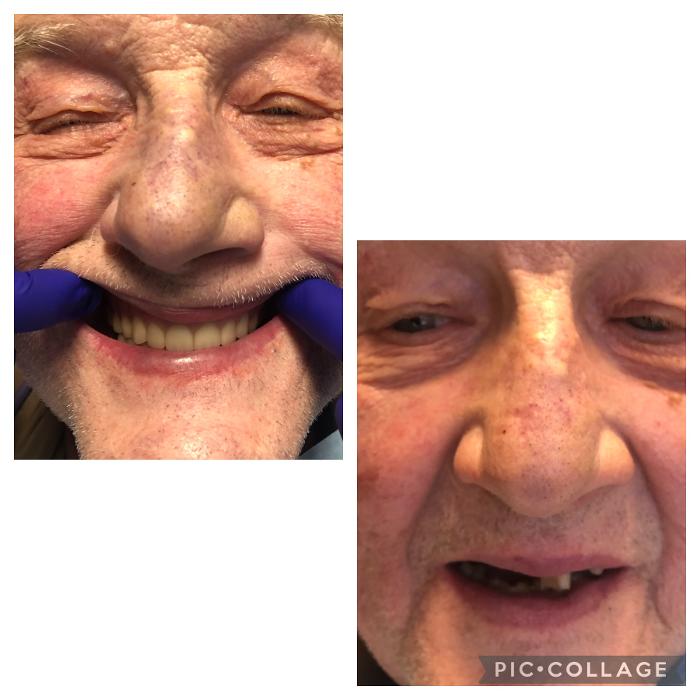 Progressive Dental Image