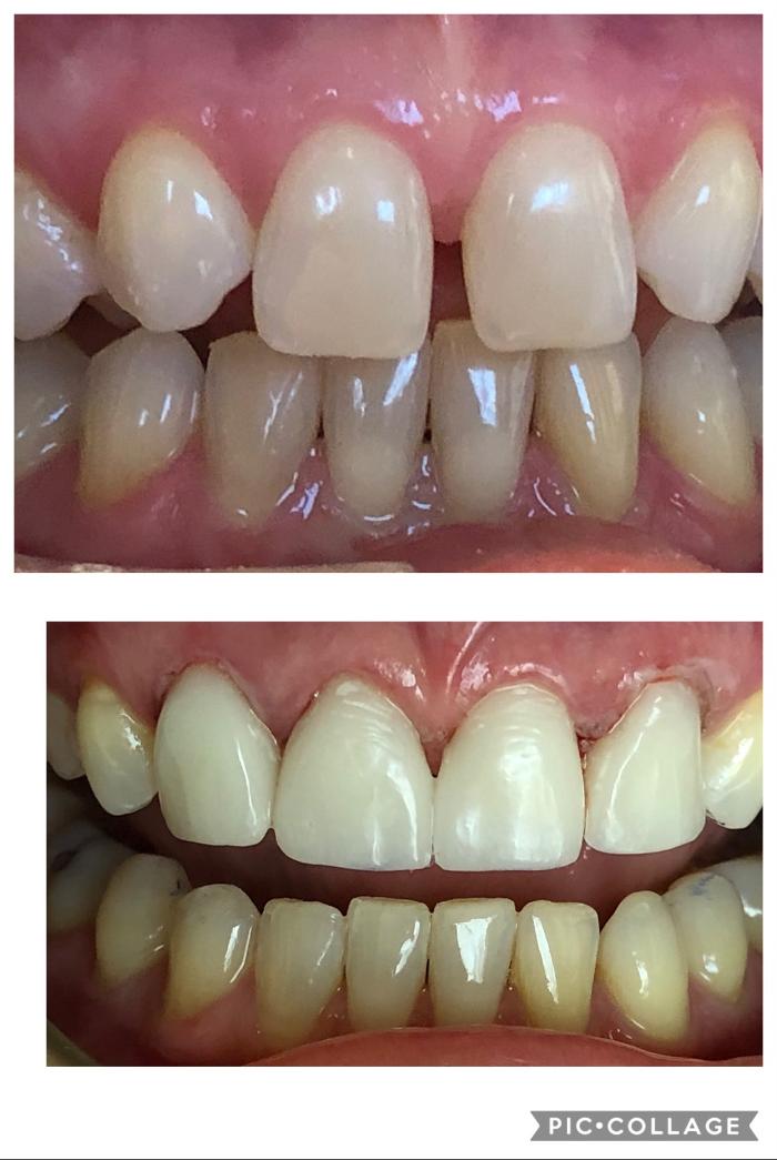 Progressive Dental Image