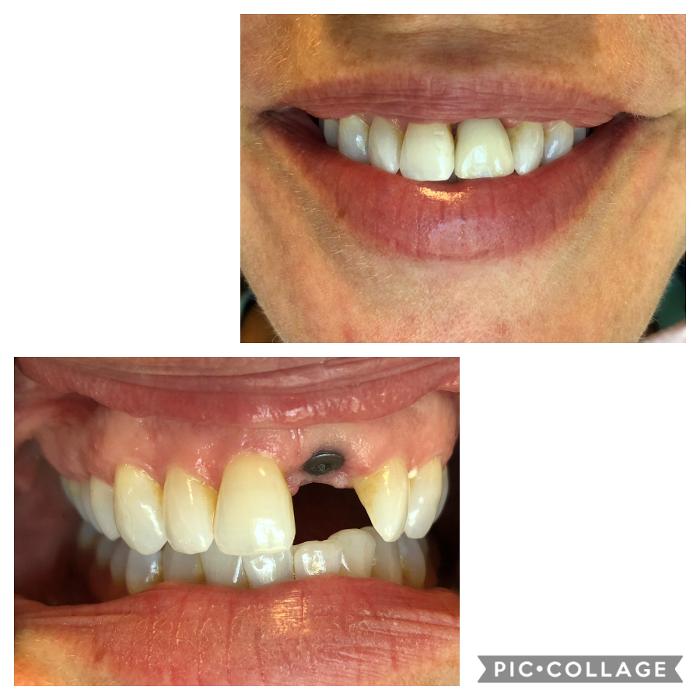 Progressive Dental Image