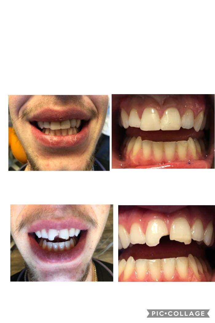 Progressive Dental Image