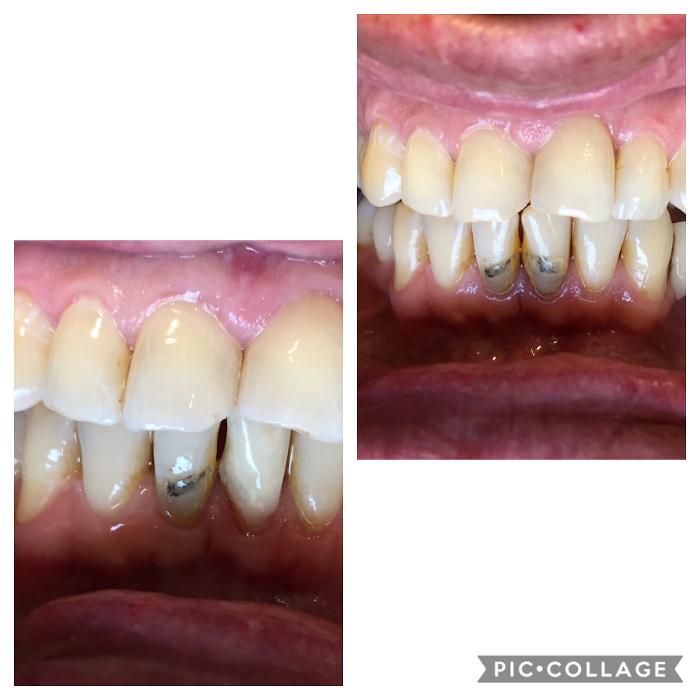 Progressive Dental Image