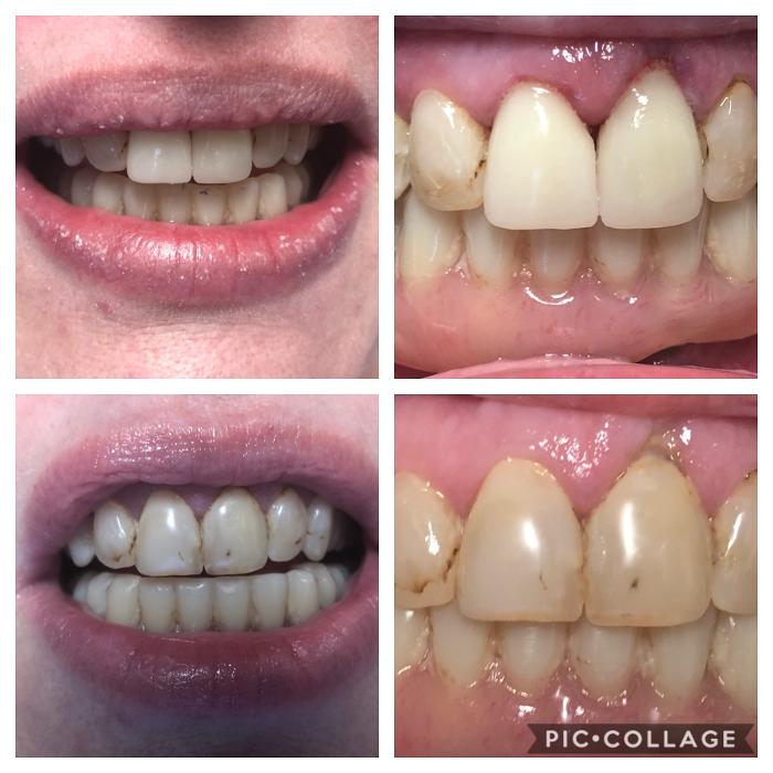 Progressive Dental Image